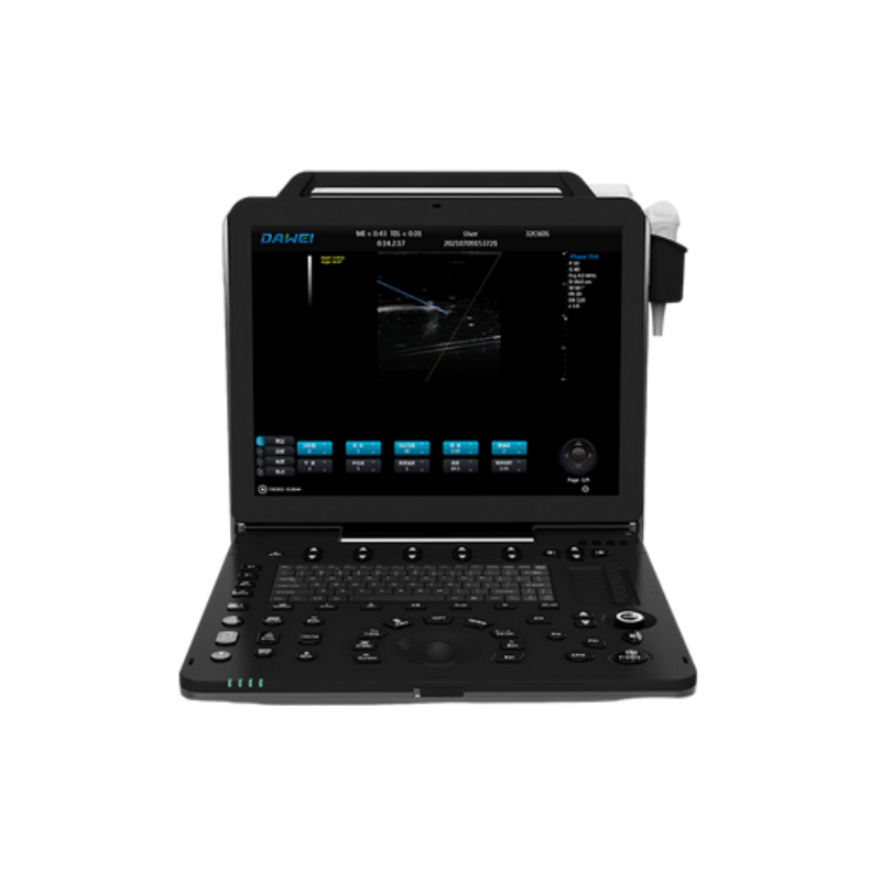 Portable Color Doppler Ultrasound System