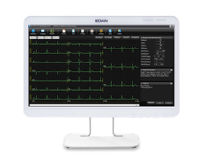 ECG Analysis System